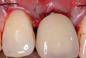 BestScope는 LED 조명, 5 단계 줌, 인체공학적 디자인을 갖춘 고성능 치과 외과 현미경을 BOM-350. - Product Image 6