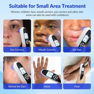 Dispositivo de Terapia de Luz Excimer de 308nm Avanzado y Dirigido ZJZK para el Tratamiento Profesional del Vitiligo, Máquina de Fototerapia UVB - Product Image 3