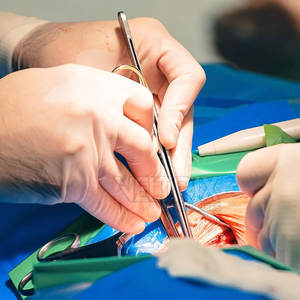 Manches de scalpel légères de style nouveau, 4 3/4, vente directe d'usine, manches de scalpel en acier inoxydable 4 3/4 - Product Image 3