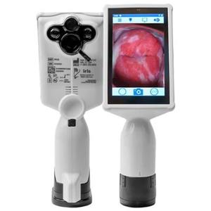 Dispositif de dépistage du cancer du col utérin GyneBio Système d'ablation thermique Dispositif précancéreux cervical - Product Image 1