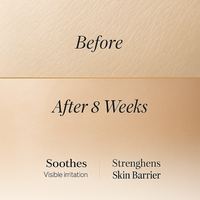 Sérum réparateur anti-rides liftant à double peptide Matrixyl 3000 avec acide hyaluronique et vitamine E pour le visage