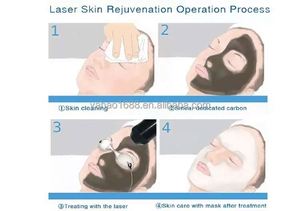 เครื่องลบรอยสักมืออาชีพ Picos Second ความยาวคลื่น 1064nm+532nm+755nm กำลังไฟ 2000W ระบบระบายความร้อนด้วยน้ำ ดีไซน์พกพาสะดวก - Product Image 6