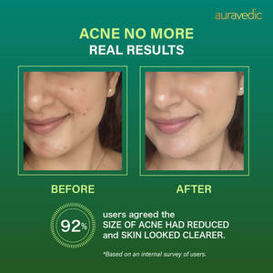 Salicylic Acid & Hyaluronic Acid <b>Face</b> Wash & <b>Serum</b>-Vegan Day & Night Home Use Firming & Moisturizing - Product Image 5