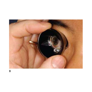 Espejo frontal personalizable OEM de alta calidad del fabricante de la India y tres goniolens de espejo - Product Image 5