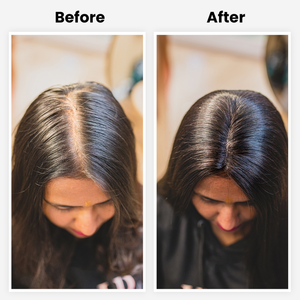 Extensions de cheveux Scalp Topper pour femmes, base en soie et 100% cheveux humains - Product Image 2