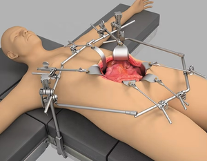 Ensemble de rétracteurs orthopédiques manuels de qualité supérieure en acier inoxydable 2026, instrument de chirurgie hépatique personnalisé pour la transplantation hépatique - Product Image 6