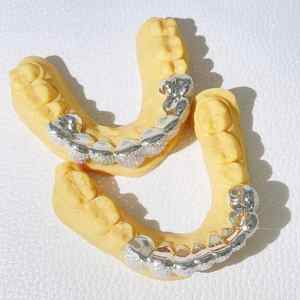 Exclusivo Moissanite Diamond Grillz Chapado en plata Haz una declaración con Iced Out Bling para cualquier actuación - Product Image 4