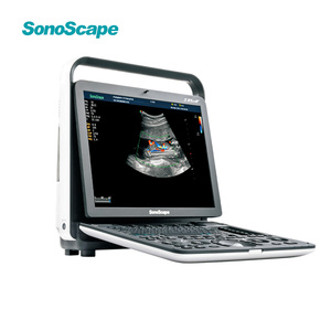 SonoScape S8 ExpV S8 Exp Sistema de Ultrasonido Doppler Color Digital Portátil, Duradero y Portátil para Clínica Veterinaria y <span class=keywords><strong>Hospital</strong></span> - Product Image 6