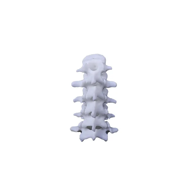 SoonSer layanan cetak 3D plastik presisi tinggi 3D dicetak pendidikan simulasi tulang belakang preoperatif
