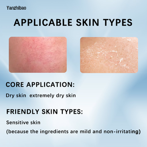 OEM Intensive Repair Körper <span class=keywords><strong>lotion</strong></span> 16,9 Unzen Alpha Hydroxy Feuchtigkeit creme für trockene Haut Peeling & Bedingungen - Product Image 5