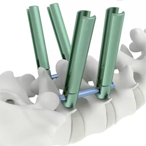 Juego de Instrumentos Quirúrgicos de Columna Vertebral de Acero Inoxidable de Alta Calidad, Tornillos Pediculares Manuales, Certificación CE, Seguridad MOL, Uso Hospitalario - Product Image 5