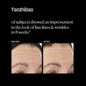 เซรั่มบำรุงผิวหน้าสูตรโออีเอ็มวิตามินซีซูเปอร์เซรั่มบวก1ออนซ์พร้อมกรดไฮยาลูโรนิกและไนอะซินาไมด์ - Product Image 4