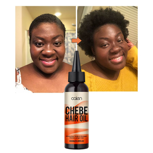 Huile <span class=keywords><strong>de</strong></span> <span class=keywords><strong>Chebe</strong></span> pure naturelle <span class=keywords><strong>de</strong></span> marque privée d'usine 100ML Huile <span class=keywords><strong>de</strong></span> soin capillaire pour la prévention <span class=keywords><strong>de</strong></span> la perte <span class=keywords><strong>de</strong></span> cheveux Nourrissante et rafraîchissante <span class=keywords><strong>Poudre</strong></span> <span class=keywords><strong>de</strong></span> <span class=keywords><strong>Chebe</strong></span> - Product Image 1