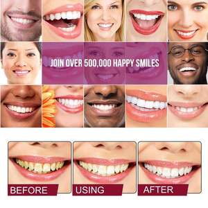 Pasta Dental Probiótica SP-4, Fórmula Blanqueadora, Elimina las Manchas Dentales, Mantiene la Salud Bucal, 120g - Product Image 3