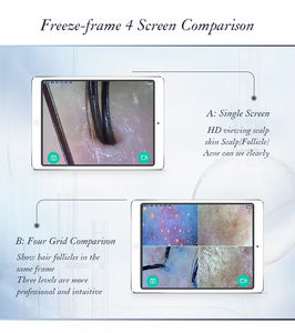 Analizador de cuero cabelludo Escáner Máquina de análisis de piel Detector de piel de folículo piloso portátil - Product Image 5