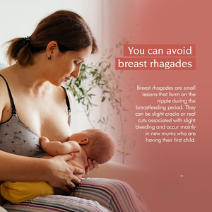 Copas de lactancia de Plata de Ley 925, protectores de pezones reutilizables para herramienta de alivio del dolor de maternidad para mamás lactantes - Product Image 4