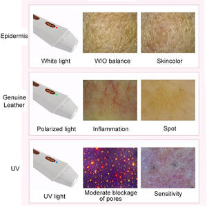 AI Smart LED <span class=keywords><strong>Skin</strong></span> <span class=keywords><strong>Analyzer</strong></span> Espelho Mágico USB Facial Tester Dispositivo de Diagnóstico de Pele Profissional para Salon & Uso Doméstico - Product Image 2