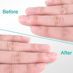 El mejor material, el más nuevo, pinzas para cutículas de Staleks, herramienta cortaúñas para dedos, producto de alta demanda - Product Image 5