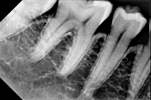 Kỹ thuật số <span class=keywords><strong>X</strong></span>-<span class=keywords><strong>Ray</strong></span> máy <span class=keywords><strong>x</strong></span>ách tay giá rẻ nha khoa <span class=keywords><strong>X</strong></span>-<span class=keywords><strong>Ray</strong></span> <span class=keywords><strong>Sensor</strong></span> với chất lượng tốt hình ảnh - Product Image 5