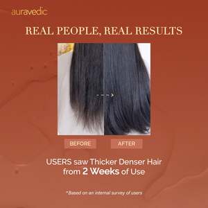 โรสแมรี่ แฮร์มิสท์ สำหรับป้องกันผมร่วง - Product Image 6