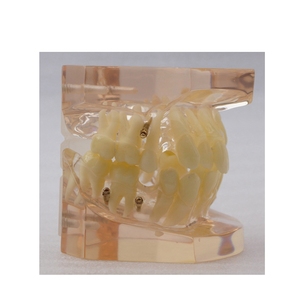 Modèle orthodontique 24 pièces sans bracket, modèle d'étude dentaire, démonstration orthodontique pour la pratique et l'enseignement en dentisterie - Product Image 2