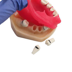 Modelo Educativo de Enseñanza Dental, Modelo de Enfermedad Periodontal - Product Image 4