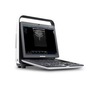 Ecógrafo Doppler Color Digital Portátil y Duradero SonoScape S8 ExpV con una Sonda S8 Exp para Clínica Veterinaria y Hospital - Product Image 3