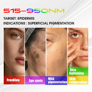 Appareil BBL avancé avec laser IPLDPL NIR, 8 filtres, 4 têtes, pour le resserrement cutané, l'élimination des pigments et le traitement de l'acné - Product Image 3