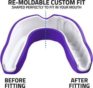 Protège-dents en caoutchouc confortable personnalisé pour le football américain, la boxe, le taekwondo, protection des dents respirante avec OEM - Product Image 4