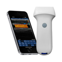Escáner de Ultrasonido Inalámbrico Joymi 8L con Sonda Lineal, 7.5/10MHz, 192 Elementos, 64 Canales, para Uso Vascular, MSK, Nervios y Tiroides