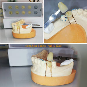 Placages <span class=keywords><strong>de</strong></span> disilicate <span class=keywords><strong>de</strong></span> lithium, implants dentaires en céramique, <span class=keywords><strong>couronne</strong></span> <span class=keywords><strong>de</strong></span> <span class=keywords><strong>dent</strong></span> avant en porcelaine, laboratoire dentaire en zircone, lingots <span class=keywords><strong>de</strong></span> pressage D13x10mm - Product Image 6