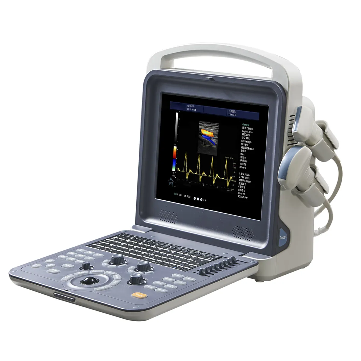 Mesin Ultrasound Doppler warna portabel, mesin pemindai Ultrasound untuk manusia