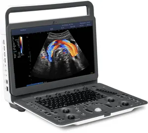 Sonoscape ultrasound scanner cardiale vasculaire kleur doppler Sonoscape E2 E3 ultrasound