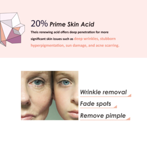 Sérum éclaircissant professionnel 20% Prime Peel Acid pour l'éclat et le soin des imperfections visage et corps OEM - Product Image 4