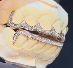 14-Piece 8X8 Custom Gold Grillz Set 10K 14K High End Luxury Quality Solid Edges CZ Tips Hip-Hop Style <b>Silver</b> Yellow White Rose - Product Image 2