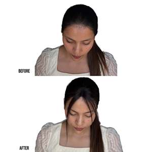 Patch de couverture pour cheveux clairsemés à l'avant, base en dentelle 2,5x1,5 pouces, ligne de cheveux naturelle, couverture du front, 100% cheveux humains, noir naturel, DIY - Product Image 3