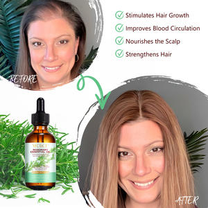 سيروم YECUCE لنمو الشعر وعلاج تساقط الشعر، زيت إكليل الجبل العضوي لنمو الشعر - Product Image 3