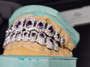 Rejilla Dental Personalizada con Gemas Moradas en Forma de Lágrima y Piedras Estilo VVS1, Juego de Rejilla Superior e Inferior Plateada Brillante para Mujer - Product Image 3