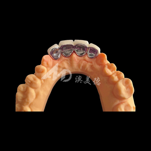 Pont <span class=keywords><strong>dentaire</strong></span> PFM : Conçu avec l'expertise <span class=keywords><strong>dentaire</strong></span>, conçu pour un confort durable - Product Image 3