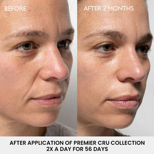 スキンケアペプチドコラーゲン血清自社ブランドスキンケアフェイス老化防止しわ微細線ペプチド血清製品 - Product Image 6