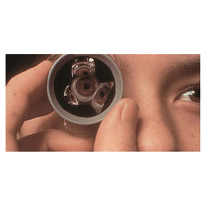 Gonio-lente de tres espejos, fabricación de la India, disponible a buen precio - Product Image 1