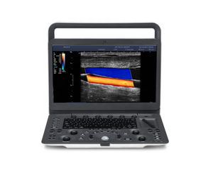 Escáner de Ultrasonido Sonoscape, Doppler Color Cardíaco y Vascular, Sonoscape E2 E3 - Product Image 4