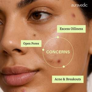 Mascarilla Facial Herbal para Eliminar el Acné en Crema, Tratamiento Natural para el Acné - Product Image 5