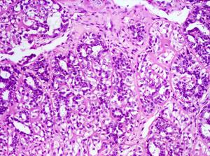 Bestscope BS-2064MH4 <span class=keywords><strong>Infinity</strong></span>修正されたLED照明と計画無色の目的を備えた三眼生物顕微鏡 - Product Image 3