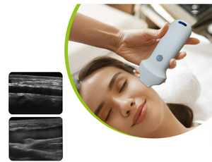 Portabel 16/20 MHz frekuensi tinggi nirkabel <span class=keywords><strong>Ultrasound</strong></span> Probe Linear WiFi konektivitas mendukung IOS Android-untuk sabun medis logam - Product Image 4
