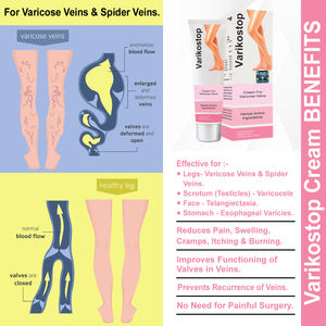 Private Label Varikostop Body Cream Sufficient Quantity for Massaging Affected Area Skin for <b>Massage</b> <b>Products</b> - Product Image 2