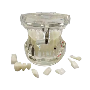 Hotseller NieuwBeijing TIANLIAN Transparant Anatomisch Tandmodel Prothese Implantaat Pathologisch Displaymodel - Product Image 2
