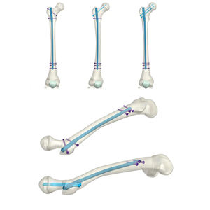 Ensemble d'instruments chirurgicaux à alimentation manuelle, système de rétracteur Pissco Greenberg, emballage personnalisé, fournisseur en gros - Product Image 2