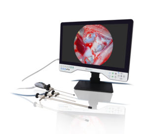 טלפאק 24 אינץ 'fhd צג מסך אנדוסקופ כלי נגינה כירורגיים עבור ארינגוסקופ - Product Image 5