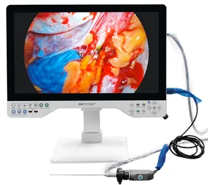 लेप्रोस्कोपी सिस्टोस्कोप सर्जरी के लिए चीन निर्माता 24 इंच एंडोस्कोपी एलईडी लाइट सोर्स एचडी एंडोस्कोप कैमरा रिकॉर्डर